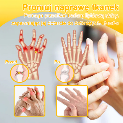 🦴TLOPA® Toksyna botulinowa i jad pszczeli Krem przeciwbólowy do gojenia kości🔥🔥🔥🔥🔥🔥