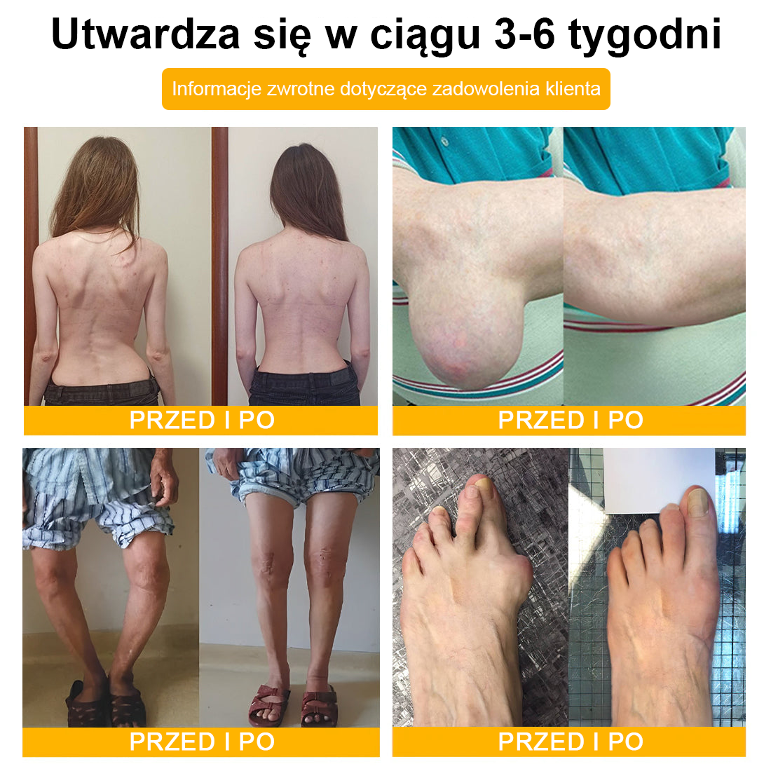 🦴TLOPA® Toksyna botulinowa i jad pszczeli Krem przeciwbólowy do gojenia kości🔥🔥🔥🔥🔥🔥