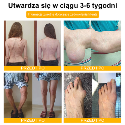🦴TLOPA® Toksyna botulinowa i jad pszczeli Krem przeciwbólowy do gojenia kości🔥🔥🔥🔥🔥🔥