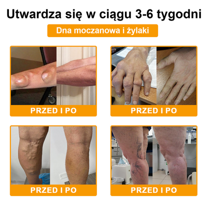 🦴TLOPA® Toksyna botulinowa i jad pszczeli Krem przeciwbólowy do gojenia kości🔥🔥🔥🔥🔥🔥