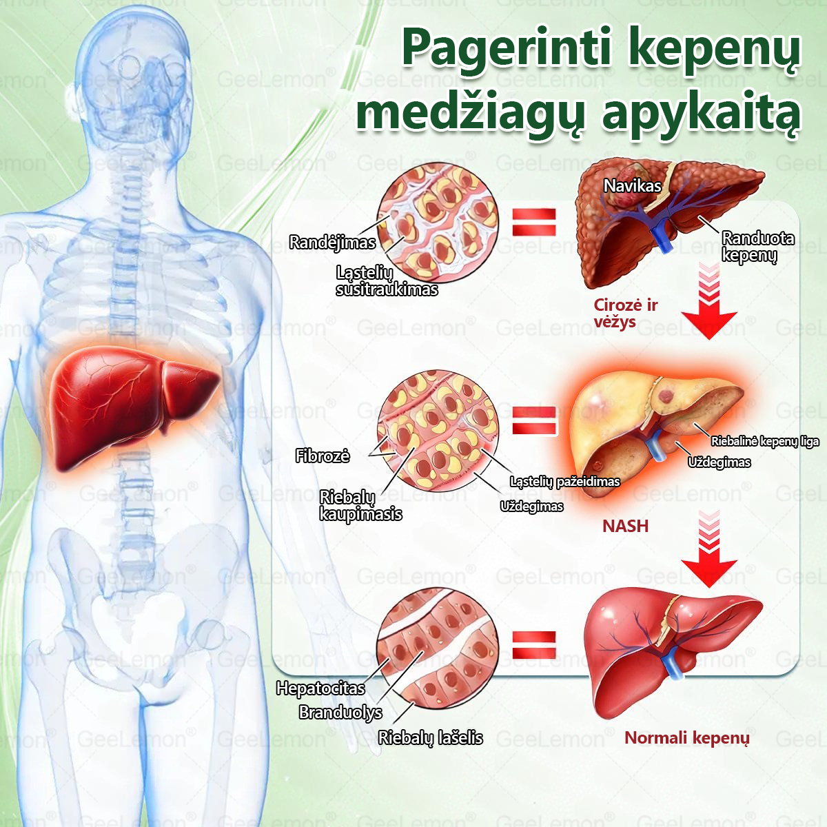 🇱🇹 Rekomenduojama šalies specialistų · 👩‍⚕️ Oficiali atstovybė Lietuvoje |👩‍⚕️ 𝐆𝐞𝑒𝐿𝑒𝐦𝐨𝐧® 𝐆𝐥𝐮𝐦𝐚𝐬𝐞𝐭𝐢𝐝𝐞 8 viename Liekninantis ir sveikatinantis nano pleistras su mikroadatomis 🇱🇹 (Tik kartą per dieną, matomi pokyčiai jau per 7 dienas) ✅
