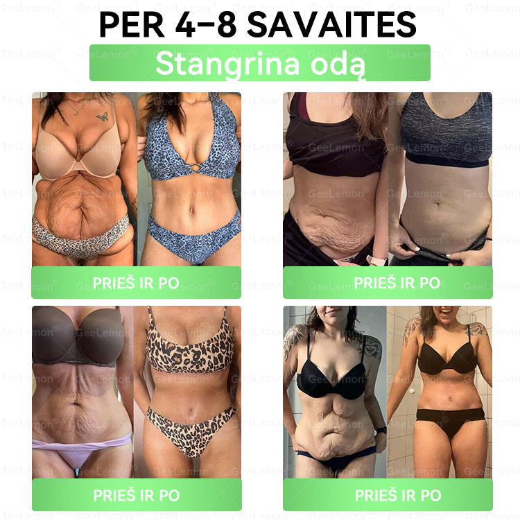 🇱🇹 Rekomenduojama šalies specialistų · 👩‍⚕️ Oficiali atstovybė Lietuvoje |👩‍⚕️ 𝐆𝐞𝑒𝐿𝑒𝐦𝐨𝐧® 𝐆𝐥𝐮𝐦𝐚𝐬𝐞𝐭𝐢𝐝𝐞 8 viename Liekninantis ir sveikatinantis nano pleistras su mikroadatomis 🇱🇹 (Tik kartą per dieną, matomi pokyčiai jau per 7 dienas) ✅
