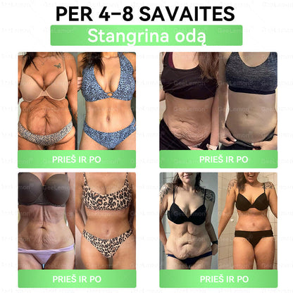 🇱🇹 Rekomenduojama šalies specialistų · 👩‍⚕️ Oficiali atstovybė Lietuvoje |👩‍⚕️ 𝐆𝐞𝑒𝐿𝑒𝐦𝐨𝐧® 𝐆𝐥𝐮𝐦𝐚𝐬𝐞𝐭𝐢𝐝𝐞 8 viename Liekninantis ir sveikatinantis nano pleistras su mikroadatomis 🇱🇹 (Tik kartą per dieną, matomi pokyčiai jau per 7 dienas) ✅