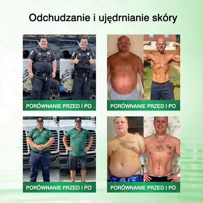 🇵🇱 Oficjalny Sklep | 👩‍⚕️ GFOUK® Moringa · Berberyna × NAD+ 10-w-1 Zaawansowany Nano Mikronakłuwający Plaster 🇪🇺 (Tylko Raz Dziennie, Widoczne Zmiany Już w 7 Dni)