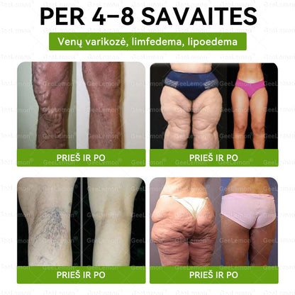 🇱🇹 Rekomenduojama šalies specialistų · 👩‍⚕️ Oficiali atstovybė Lietuvoje |👩‍⚕️ 𝐆𝐞𝑒𝐿𝑒𝐦𝐨𝐧® 𝐆𝐥𝐮𝐦𝐚𝐬𝐞𝐭𝐢𝐝𝐞 8 viename Liekninantis ir sveikatinantis nano pleistras su mikroadatomis 🇱🇹 (Tik kartą per dieną, matomi pokyčiai jau per 7 dienas) ✅