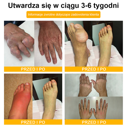 🦴TLOPA® Toksyna botulinowa i jad pszczeli Krem przeciwbólowy do gojenia kości🔥🔥🔥🔥🔥🔥